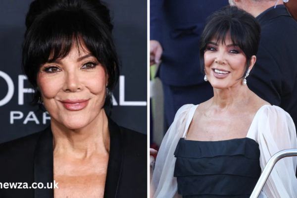 Kris Jenner Facelift