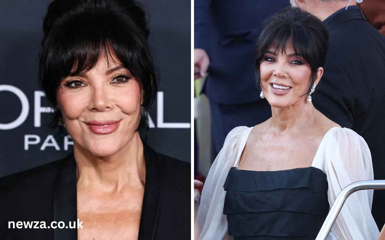 Kris Jenner Facelift
